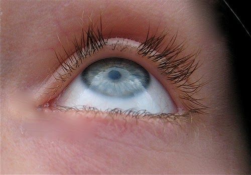 Close-up photo of an eye with visibly damaged natural eyelashes caused by home lash extensions